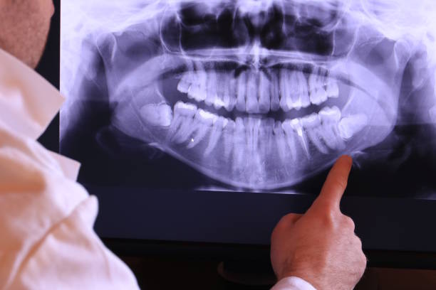 Best Tooth Infection Emergency Dentist  in Maumee, OH